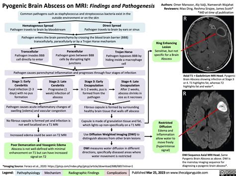 Pyogenic Brain Abscess on MRI: Findings and Pathogenesis | Calgary Guide