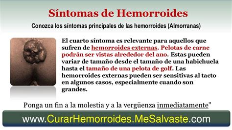 Hemorroides Sintomas y Tratamiento [Almorranas] - Como Curar las Hemo…