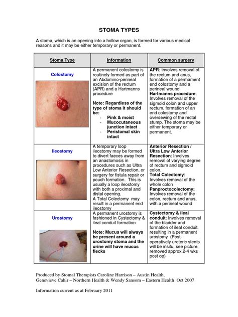 STOMA TYPES.pdf | Gastroenterology | Medical Procedures