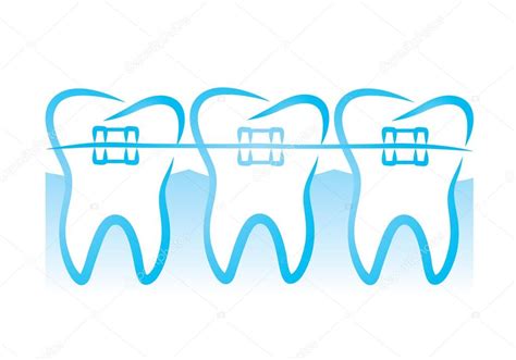 Teeth braces — Stock Vector © Volchonok #24779299