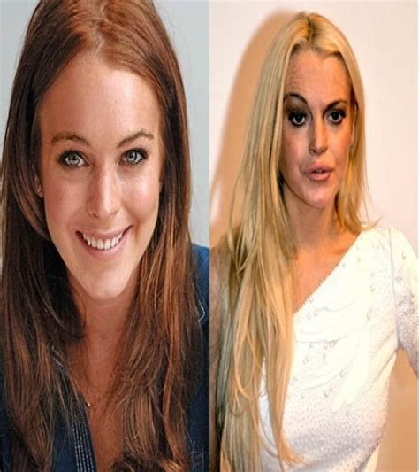 60 Worst Cases Of Celebrity Plastic Surgery Gone Wrong 8E9