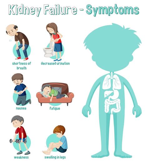 infografía de información de síntomas de insuficiencia renal 1503947 ...