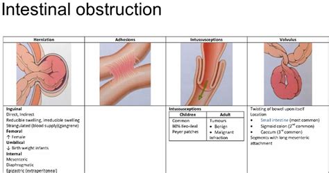 Bowel Obstruction - Small & Large - Causes, Symptoms, Treatment