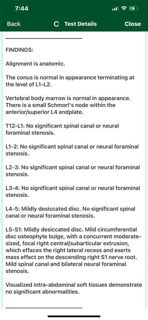 MRI Results : r/Sciatica