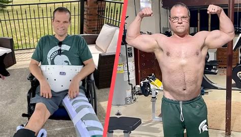 TRT Before and After: Testosterone Replacement Therapy Photos