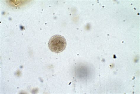 Entamoeba coli – Cyst – Parasitology