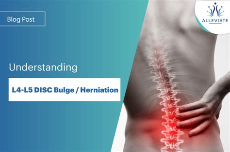 L4-L5 Disc Bulge and Herniation | Symptoms | Investigations | Treatment ...