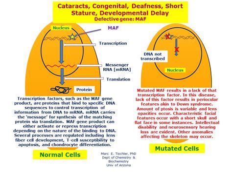 Cataracts, Congenital, Deafness, Short Stature, Developmental Delay ...