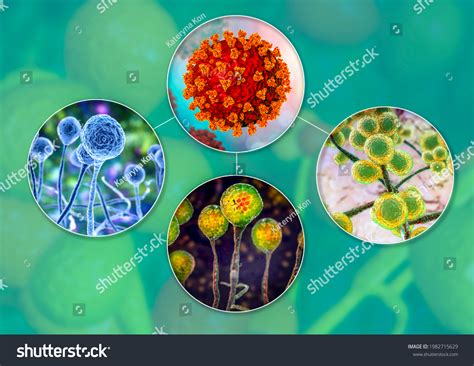 Fungal Complications Covid19 3d Illustration Covid19associated Stock ...