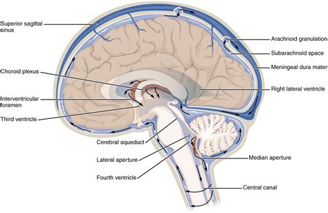 Low pressure hydrocephalus - Wikipedia