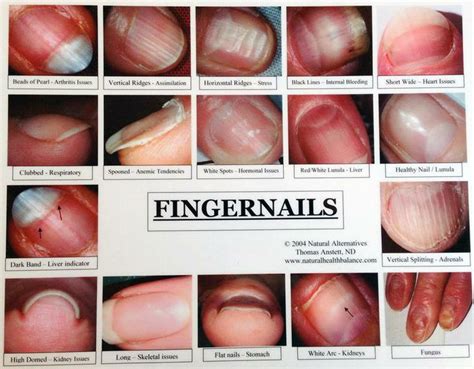 Pin by Ashley Layfield on Young essentials oils | Nail health signs ...