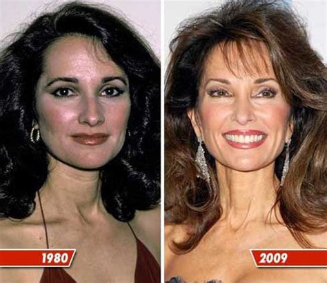 Susan Lucci Plastic Surgery Before and After | Plastic Surgery Magazine