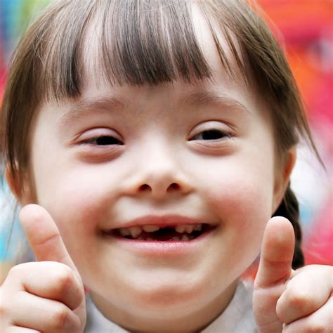 11 Facts About Down Syndrome | DoSomething.org