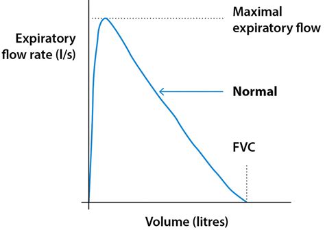 Spirometry test, spirometry results & spirometry interpretation