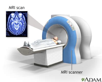 HIE Multimedia - Head MRI