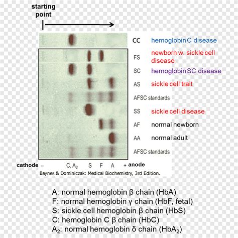 Hemoglobin Electrophoresis Sickle Cell