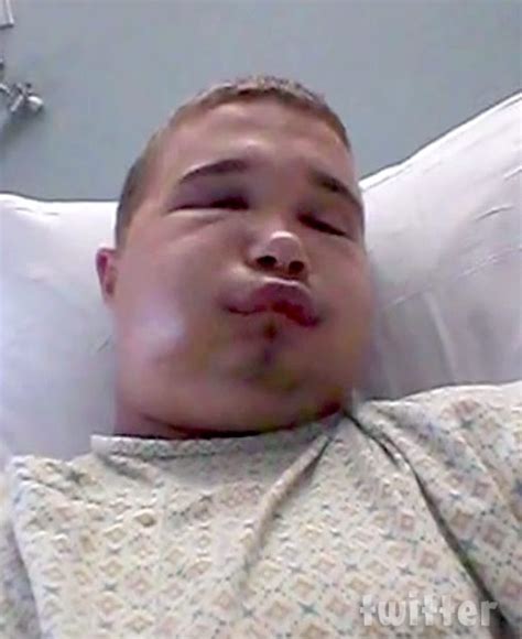 PHOTOS Florida man Austin Hatfield bitten by cottonmouth while kissing ...