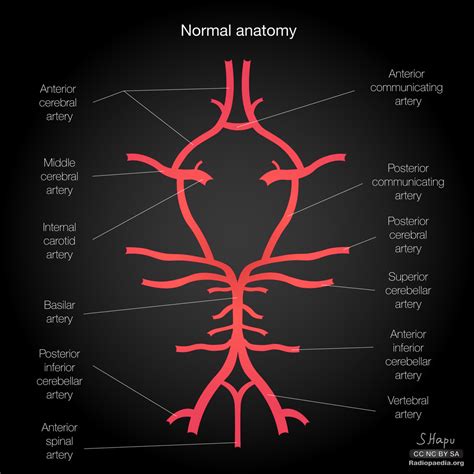 Brain Inferior View Circle Of Willis