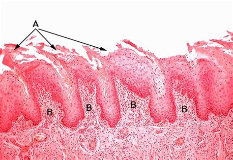 Section of Filiform Papillae