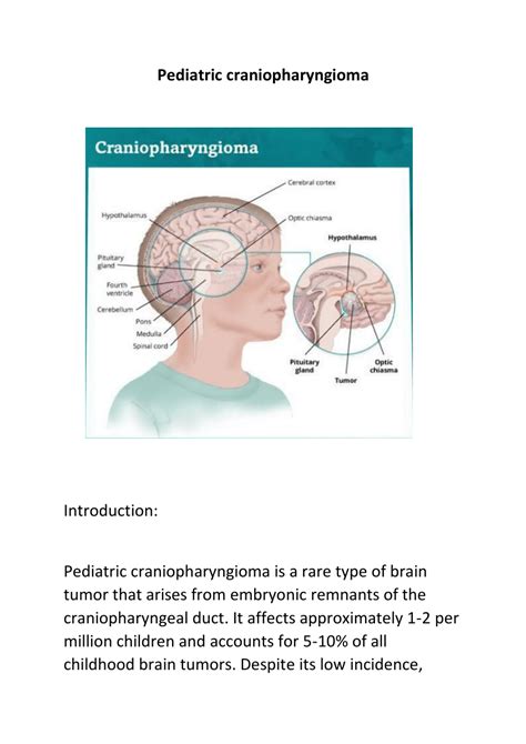 (PDF) Pediatric craniopharyngioma