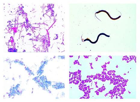 Bacteria, 25 microscope slides | PHYWE