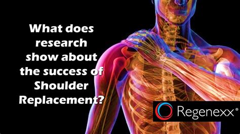 Shoulder Replacement Recovery: Rotator Cuff Anatomy Image - Regenexx