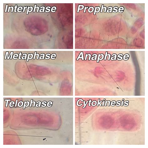 Stages Of Mitosis Under Microscope