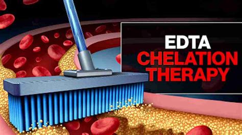 Chelation Therapy | EDTA Intravenous Chelation Treatment | Arizona