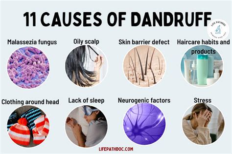 11 Causes of Dandruff: What Exactly Is It?