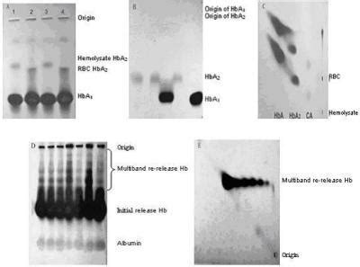 New discoveries on the state of hemoglobin in living red blood cells ...