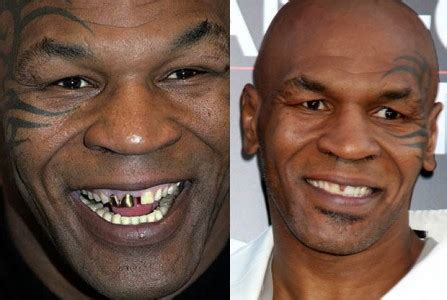 MIKE TYSON teeth – TheCount.com