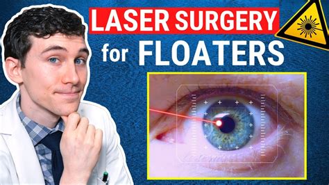 eye floater laser treatment cost - roman-dunemann