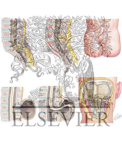 Neural Tube Defects