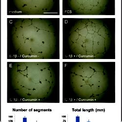 Angiogenesis assay with quantitative image analysis.