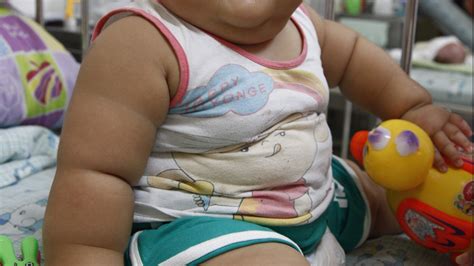 Larger babies more likely to be obese as adults