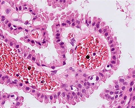 Choroid Plexus Histology