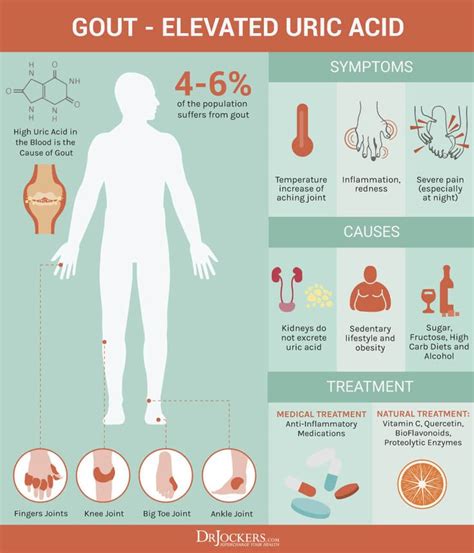 Gout: Symptoms, Causes and Natural Support Strategies | Gout remedies ...