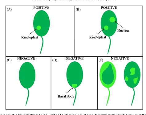 Figure 2 from A decision support system for Crithidia Luciliae image ...