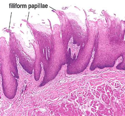 List of the histology specimens: Filiform papillae tongue