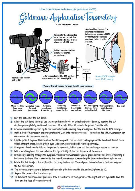 How to Measure Intraocular Pressure (Goldmann Applanation Tonometery ...