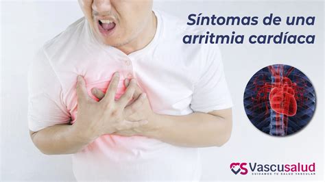 Síntomas de una arritmia cardíaca - Vascusalud