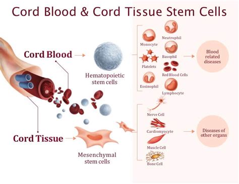 Difference between cord blood and cord tissue stem cells - Healthcord