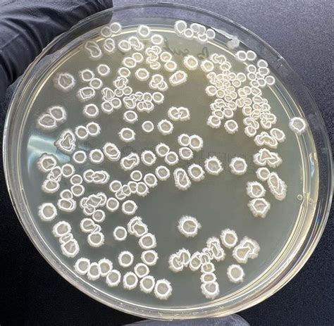 🔥Bacillus subtilis en TSA 🧫 🦠Bacillus subtilis es una bacteria Gram ...