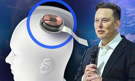 Elon Musk’s Neuralink brain chip demo explained – Cyber Tech TV