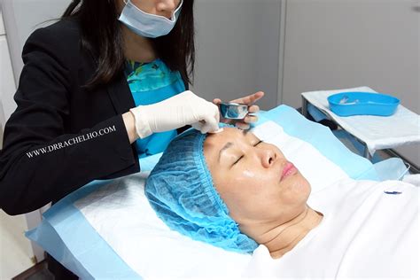 Dr Rachel Ho | 10 Things to Know Before Having Lasers For Your Pigmentation