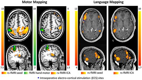 pasobpeople.blogg.se - Analysis of functional mri time-series. human ...