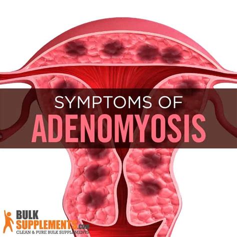 What is Adenomyosis: Causes, Symptoms & Treatment