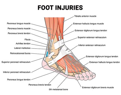 Foot Injuries (Treatment, Recovery) | Premier Podiatry