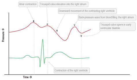 Interpretation of the central venous pressure waveform | Deranged ...