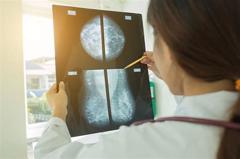 Understanding the Process of the Mammogram Procedure